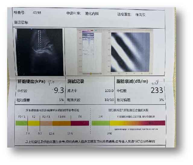 河南肝病那个医院看的好?郑州肝病医院在哪里