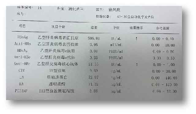 河南肝病那个医院看的好?郑州肝病医院在哪里