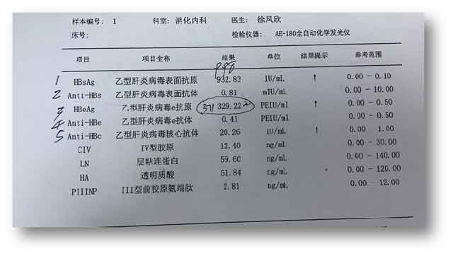 河南肝病那个医院看的好?郑州肝病医院在哪里