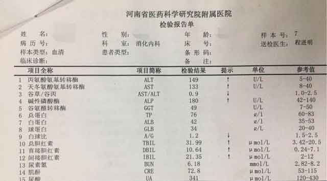 河南好的肝硬化医院?郑州什么医院治疗肝硬化好